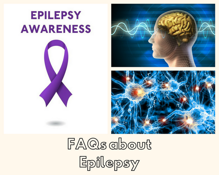 FAQs about Epilepsy